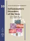 Inflammatory Disorders of the Skin cover