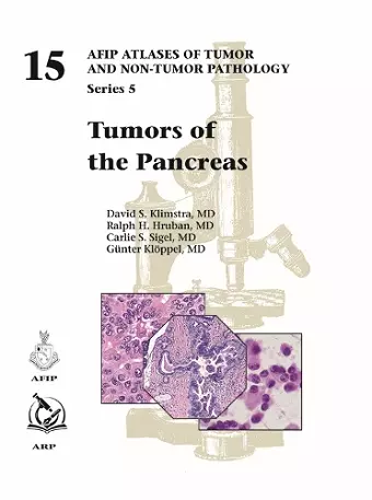 Tumors of the Pancreas cover