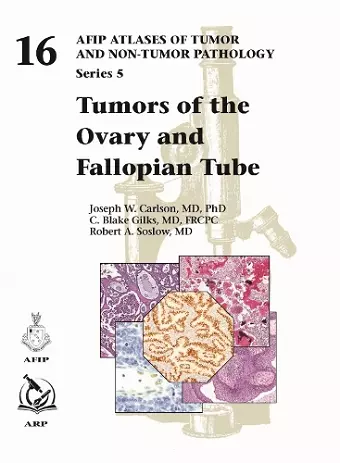 Tumors of the Ovary and Fallopian Tube cover