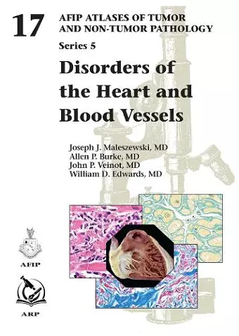 Disorders of the Heart and Blood Vessels cover