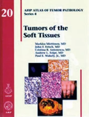 Tumors of the Soft Tissues cover