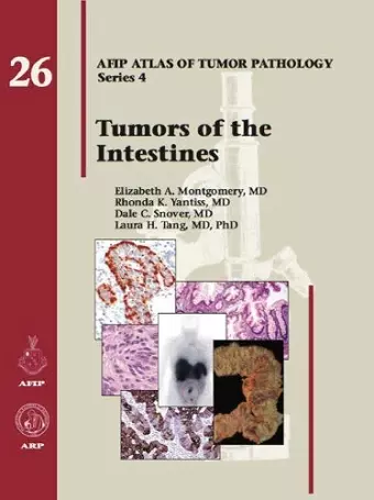 Tumors of the Intestines cover