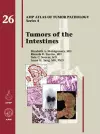 Tumors of the Intestines cover