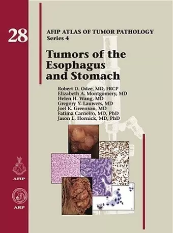 Tumors of the Esophagus and Stomach cover