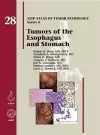 Tumors of the Esophagus and Stomach cover