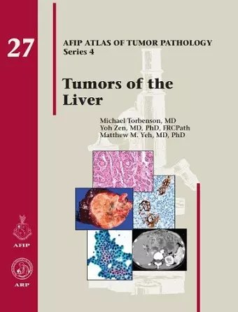 Tumors of the Liver cover