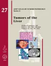 Tumors of the Liver cover