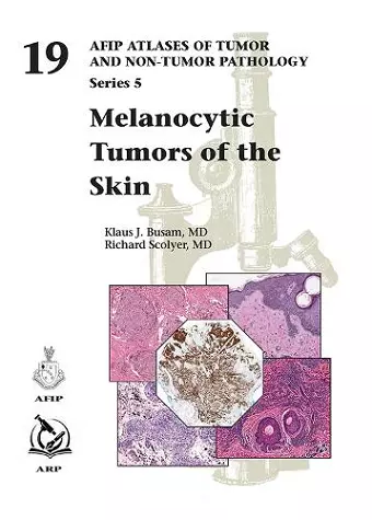 Melanocytic Tumors of the Skin cover