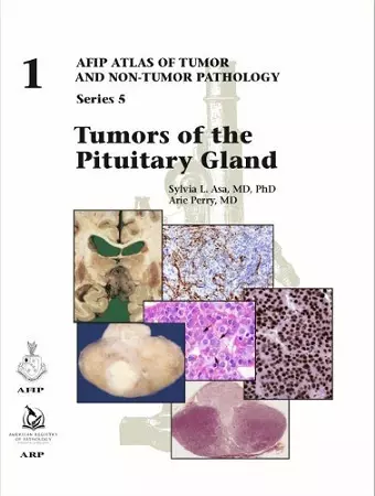 Tumors of the Pituitary Gland cover