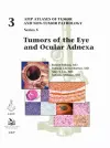 Tumors of the Eye and Ocular Adnexa cover