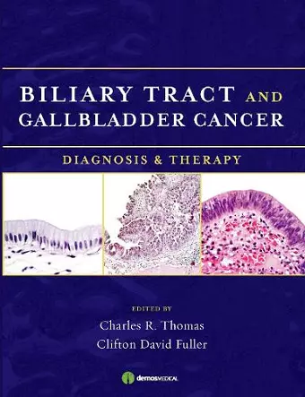 Biliary Tract and Gallbladder Cancer cover