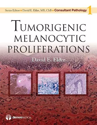 Tumorigenic Melanocytic Proliferations cover