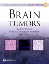 Brain Tumors cover
