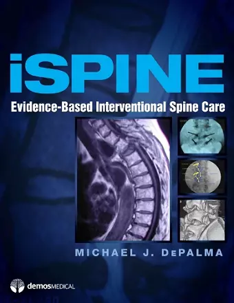 iSpine cover