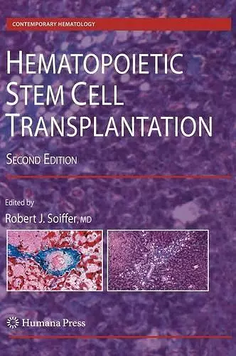 Hematopoietic Stem Cell Transplantation cover