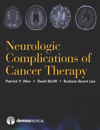 Neurologic Complications of Cancer Therapy cover