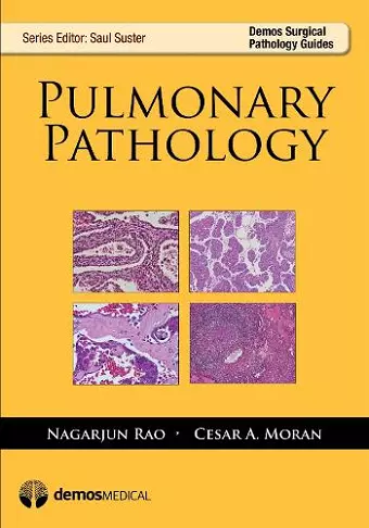 Pulmonary Pathology cover