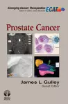 Prostate Cancer cover