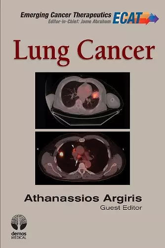 Lung Cancer cover