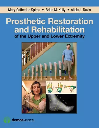 Prosthetic Restoration and Rehabilitation of the Upper and Lower Extremity cover