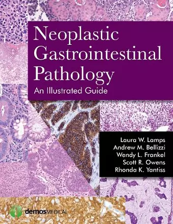 Neoplastic Gastrointestinal Pathology cover