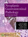 Neoplastic Gastrointestinal Pathology cover