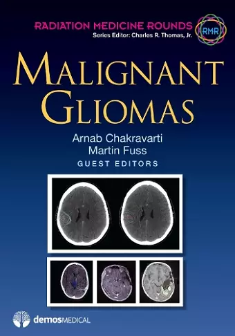 Malignant Gliomas cover