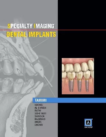 Specialty Imaging: Dental Implants cover