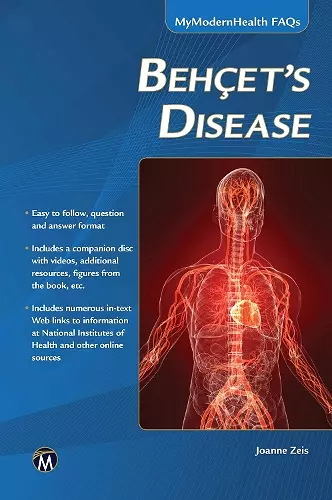 Behcet’s Disease cover