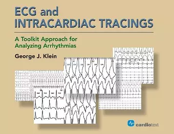 ECG and Intracardiac Tracings cover