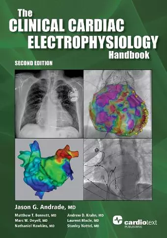 The Clinical Cardiac Electrophysiology Handbook, Second Edition cover