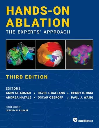 Hands-On Ablation: The Experts' Approach, Third Edition cover
