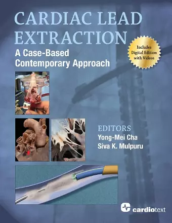 Cardiac Lead Extraction: A Case-Based Contemporary Approach cover