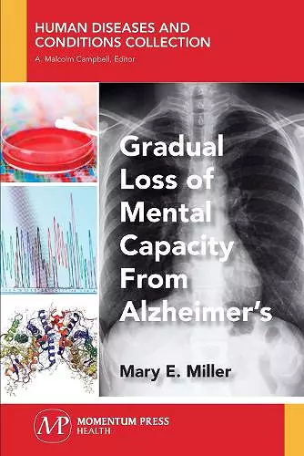 Gradual Loss of Mental Capacity from Alzheimer's cover