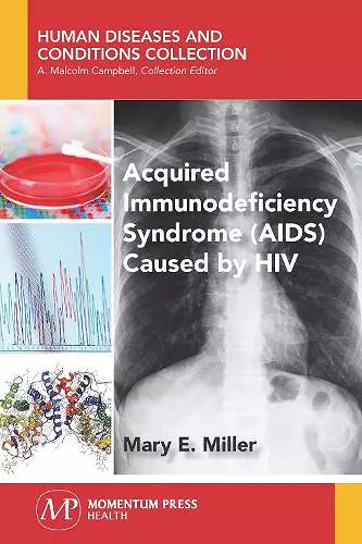 Acquired Immunodeficiency Syndrome (AIDS) Caused by HIV cover