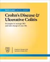 Mayo Clinic On Crohn's Disease And Ulcerative Colitis cover
