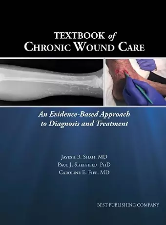 Textbook of Chronic Wound Care cover