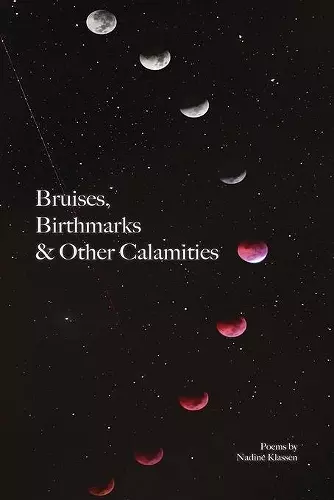 Bruises, Birthmarks & Other Calamities cover