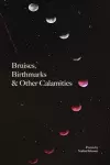 Bruises, Birthmarks & Other Calamities cover