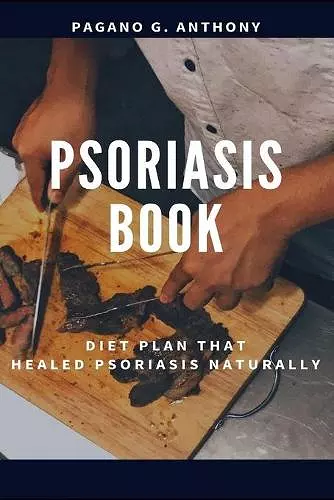 Psoriasis Book cover