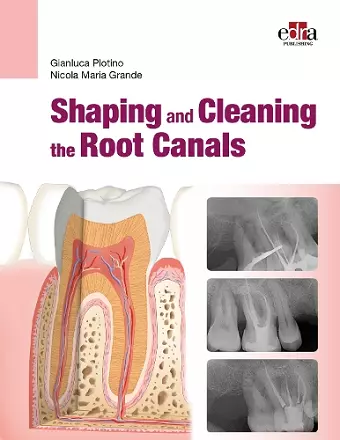 Shaping and Cleaning the Root Canal System cover