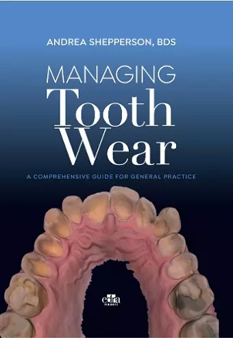 Managing Tooth Wear cover