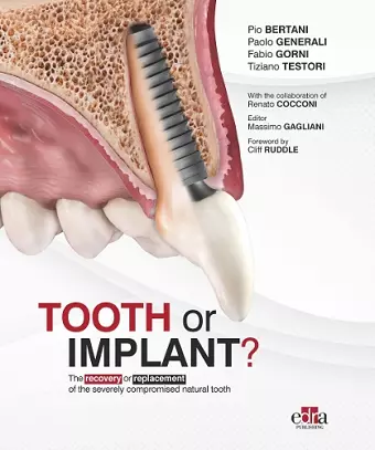 Tooth or Implant cover