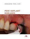Peri-implant Diseases: The Laser Solution cover