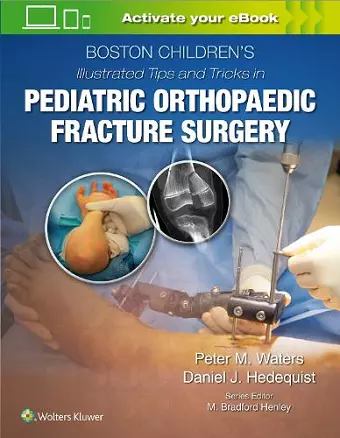 Boston Children’s Illustrated Tips and Tricks  in Pediatric Orthopaedic Fracture Surgery cover