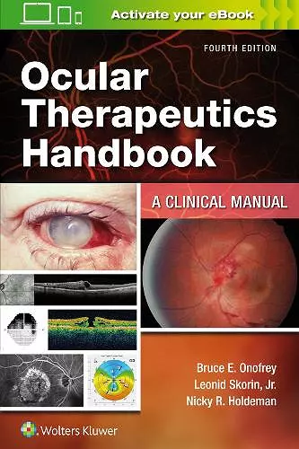 Ocular Therapeutics Handbook cover