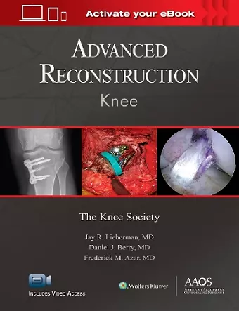 Advanced Reconstruction: Knee: Print + Ebook with Multimedia cover