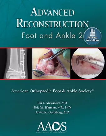 Advanced Reconstruction: Foot and Ankle 2: Print + Ebook cover