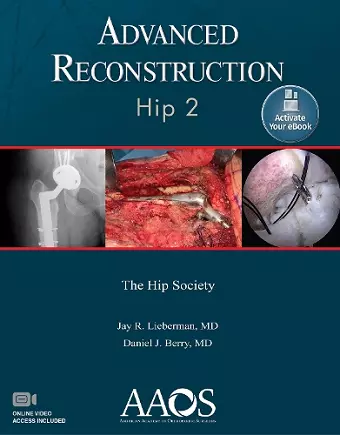 Advanced Reconstruction: Hip 2: Print + Ebook with Multimedia cover