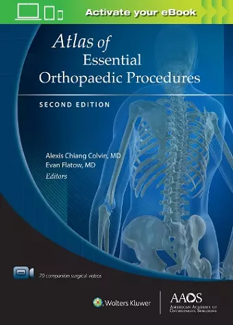 Atlas of Essential Orthopaedic Procedures, Second Edition: Print + Ebook with Multimedia cover